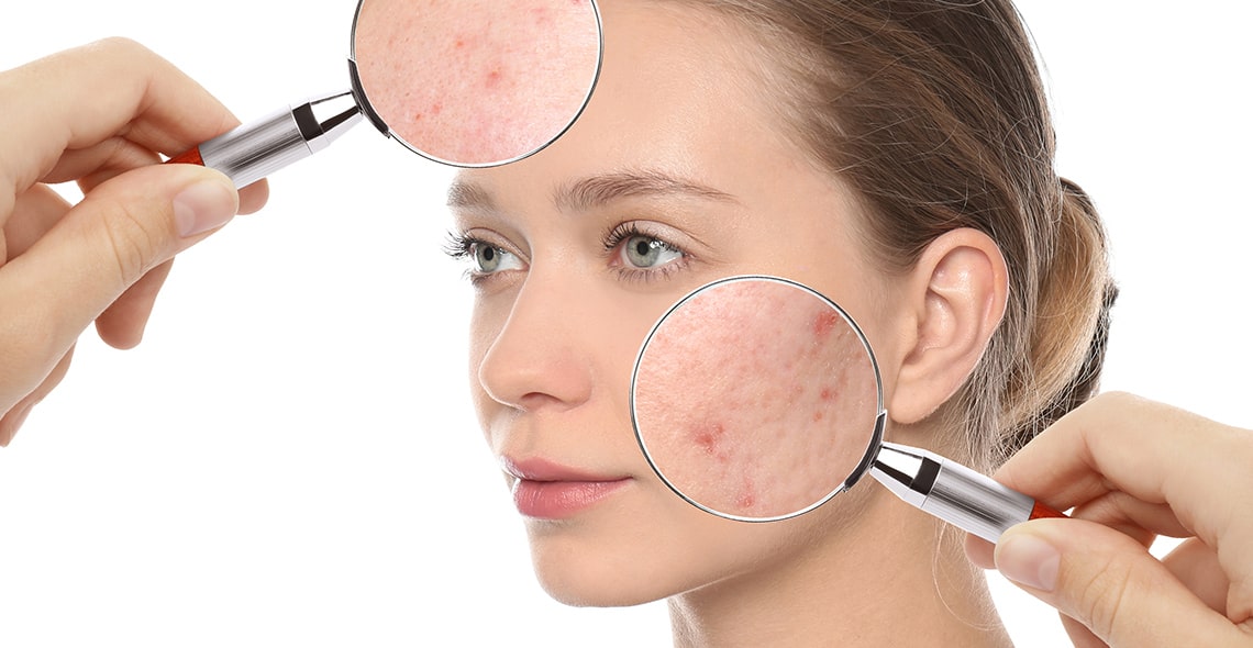 Skin Reveals Health Problems